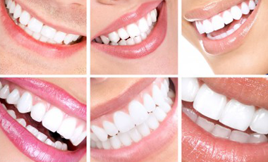 8 Ways to Get a Better Smile